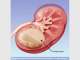 Dr Martin Elmes - Robotic, Laparoscopic & Kidney Stone Urological Surgeon