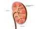 Dr Martin Elmes - Robotic, Laparoscopic & Kidney Stone Urological Surgeon