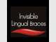 Invisible Lingual Braces Invisible Lingual Braces